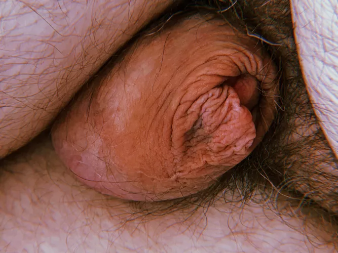 [32] here’s my tiny belly button dick. Hope you like it.