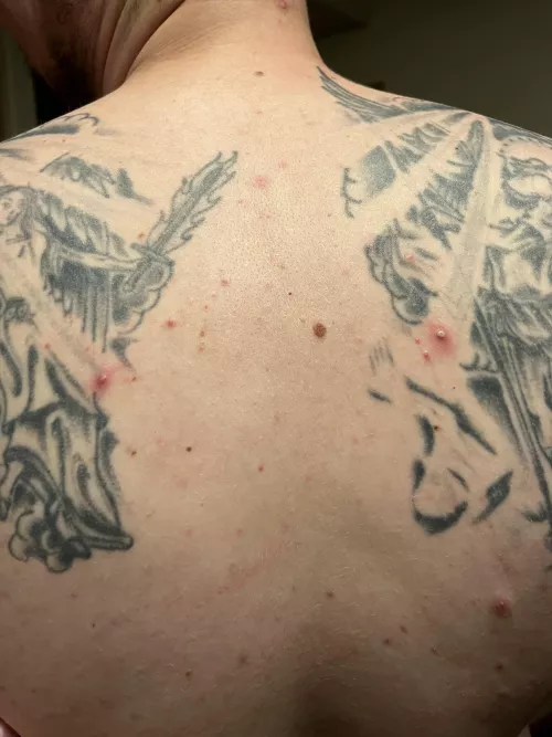 Boyfriend said he had some gold mines on his back tonight, I would agree 😅 Didn’t film any popping unfortunately but all of the pops were anticlimactic anyways 😂