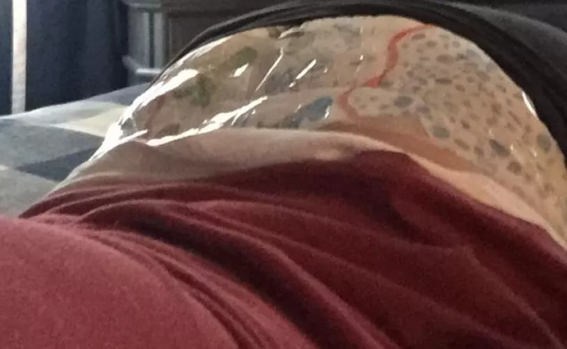 Different type of whale tail🐳 sticking out of my pants