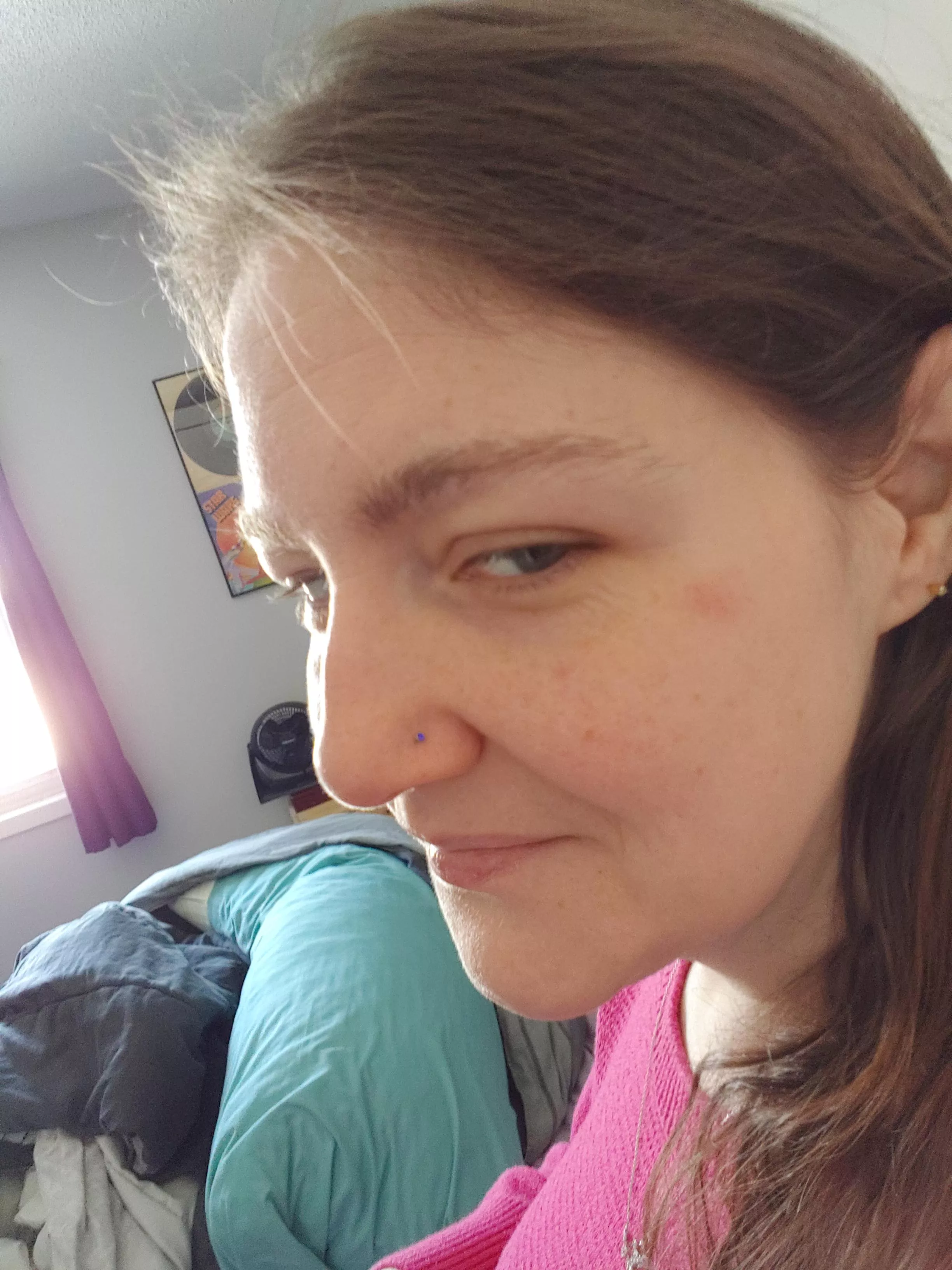 Eczema girls get noticed 🤣. Flashing back to the '90s today 😁