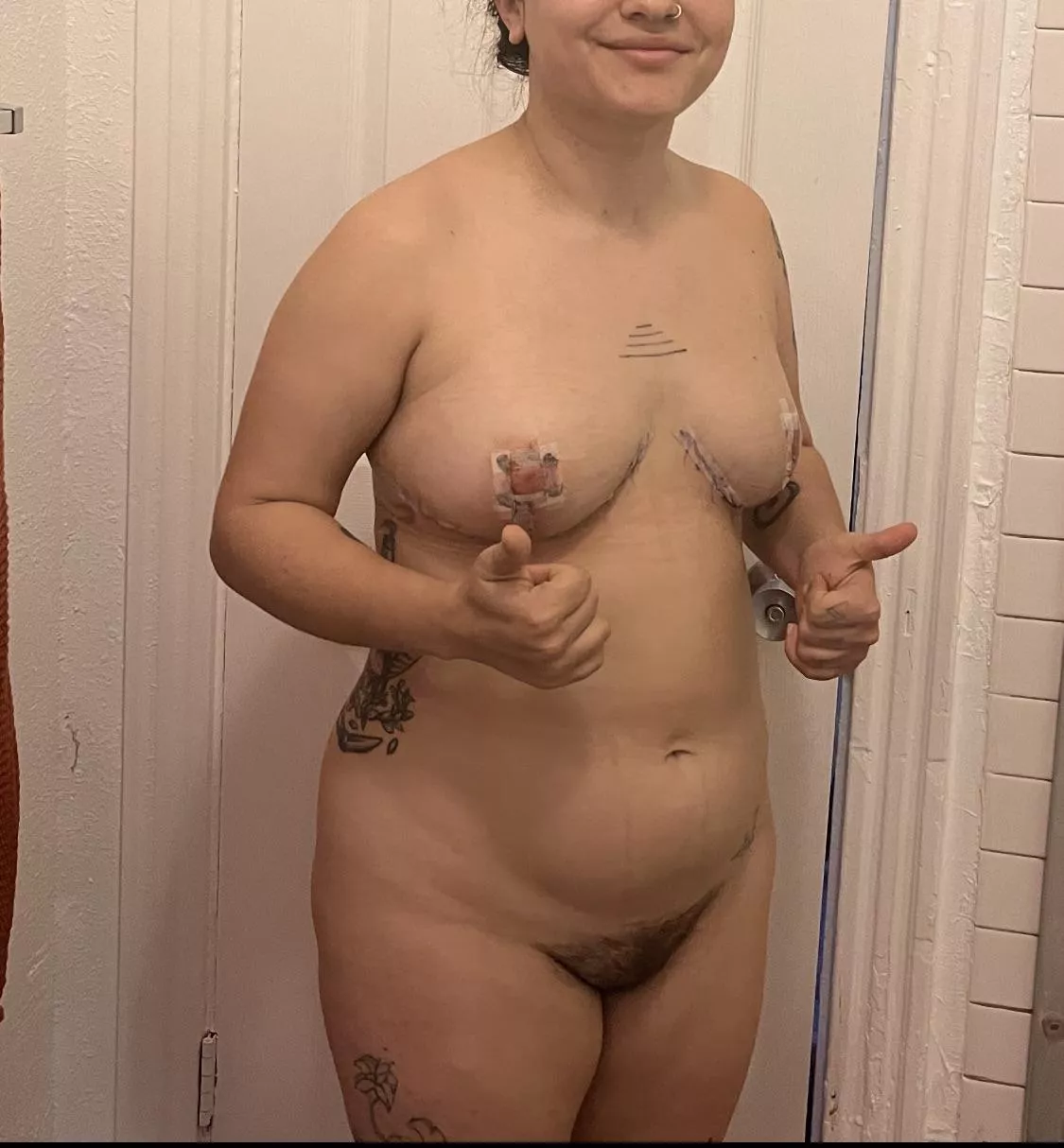 f, 26yo, 152 lbs, 5’0”. 2 days after breast reduction surgery. it hurt too much to relax my shoulders back, stand up straight, do all the things I do to feel attractive and comfortable. and yet, I felt SO much more like myself, like I had the body I f, 26yo, 152 lbs, 5’0”. 2 days after breast reduction surgery. it hurt too much to relax my shoulders back, stand up straight, do all the things I do to feel attractive and comfortable. and yet, I felt SO much more like myself, like I had the body I