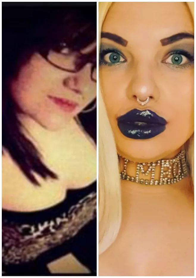 From 0cc to 15cc Lips 💋 Want to have 30cc until the End of the Year 🥰