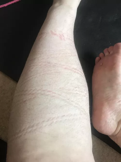 I love the rope marks after I've been tied!