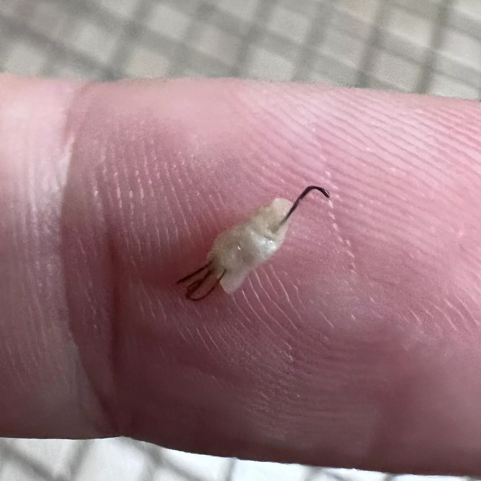 Ingrown pili multigemini 🤢