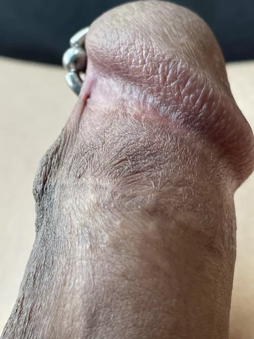 Keratinised patterns.