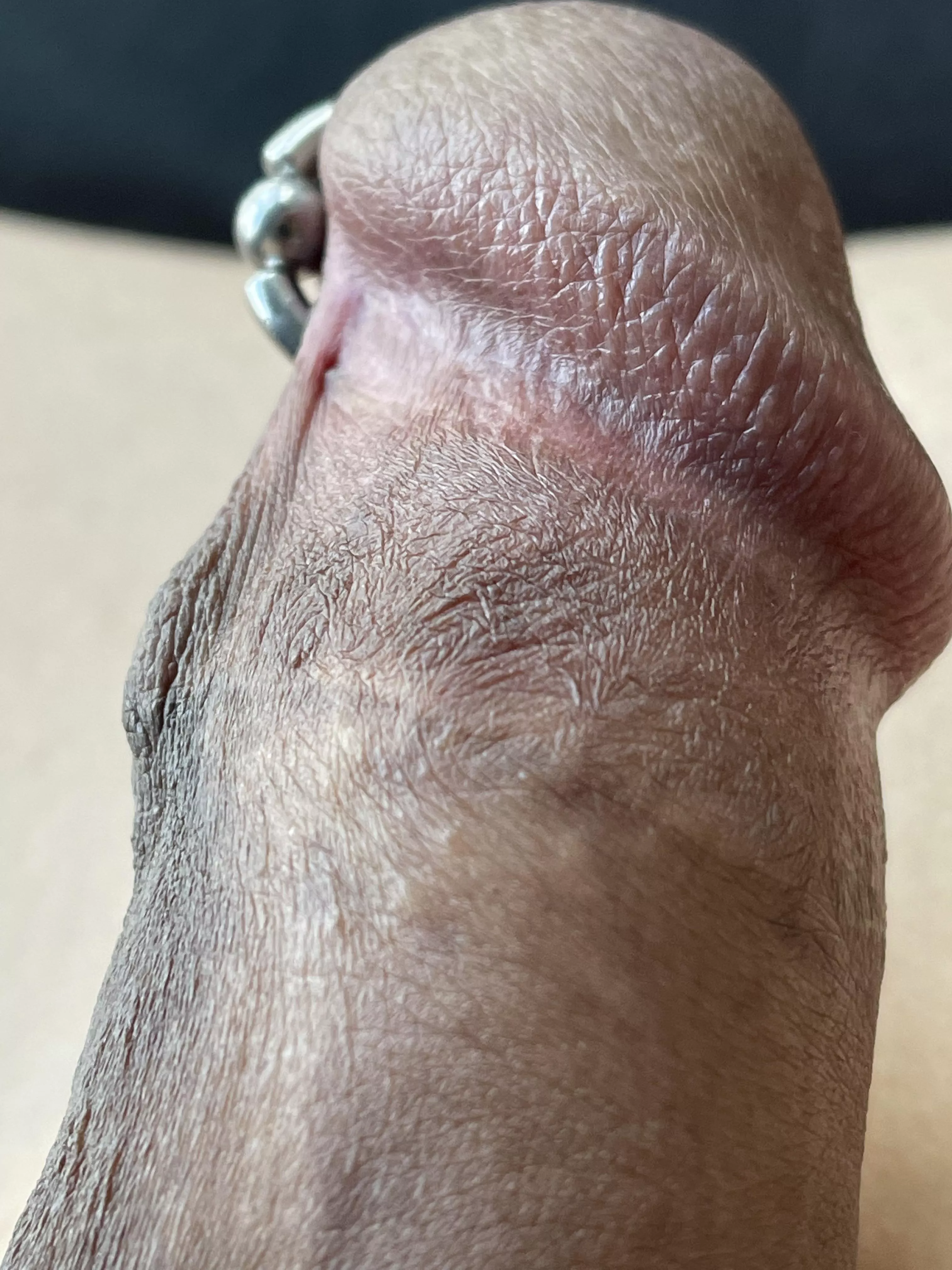 Keratinised patterns.