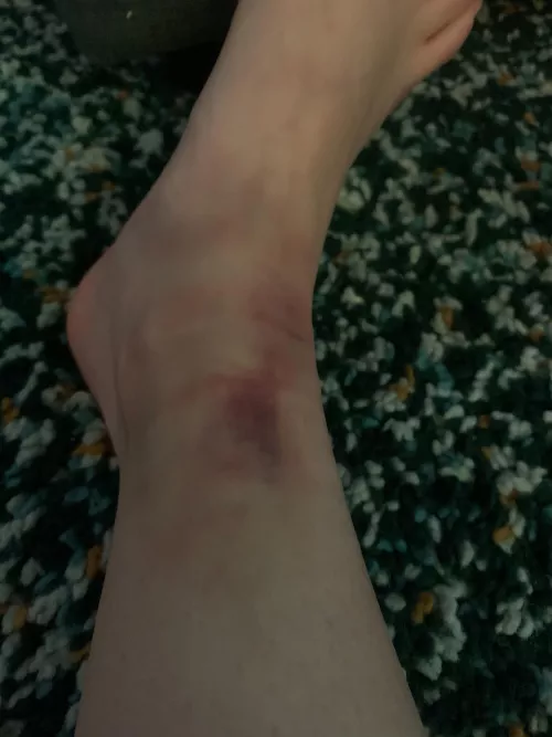 Love when it hurts ❤️