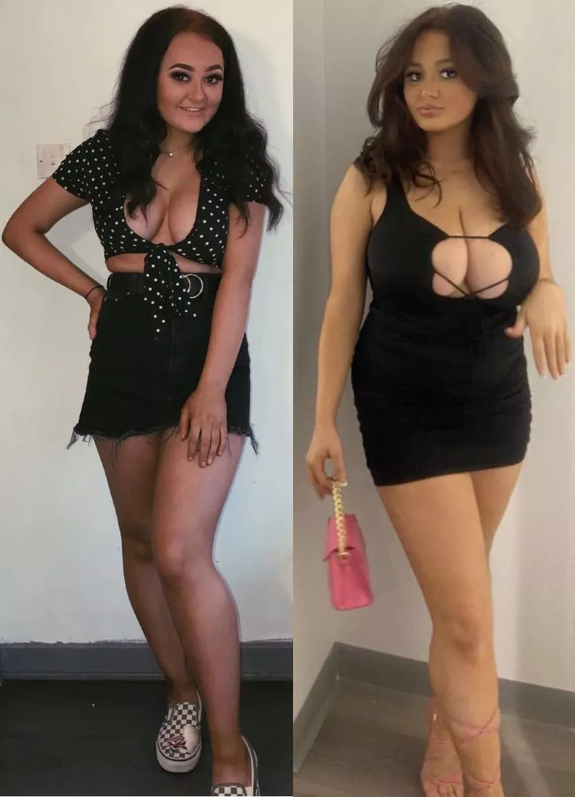 Mia.ely huge breast growth