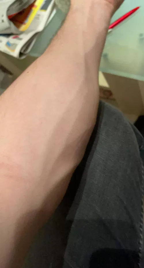 My forearm right mlw My forearm right mlw