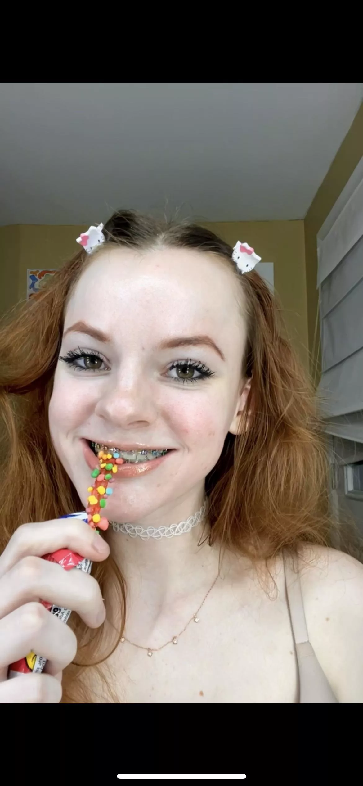 Rainbow candy to match my braces ❤️