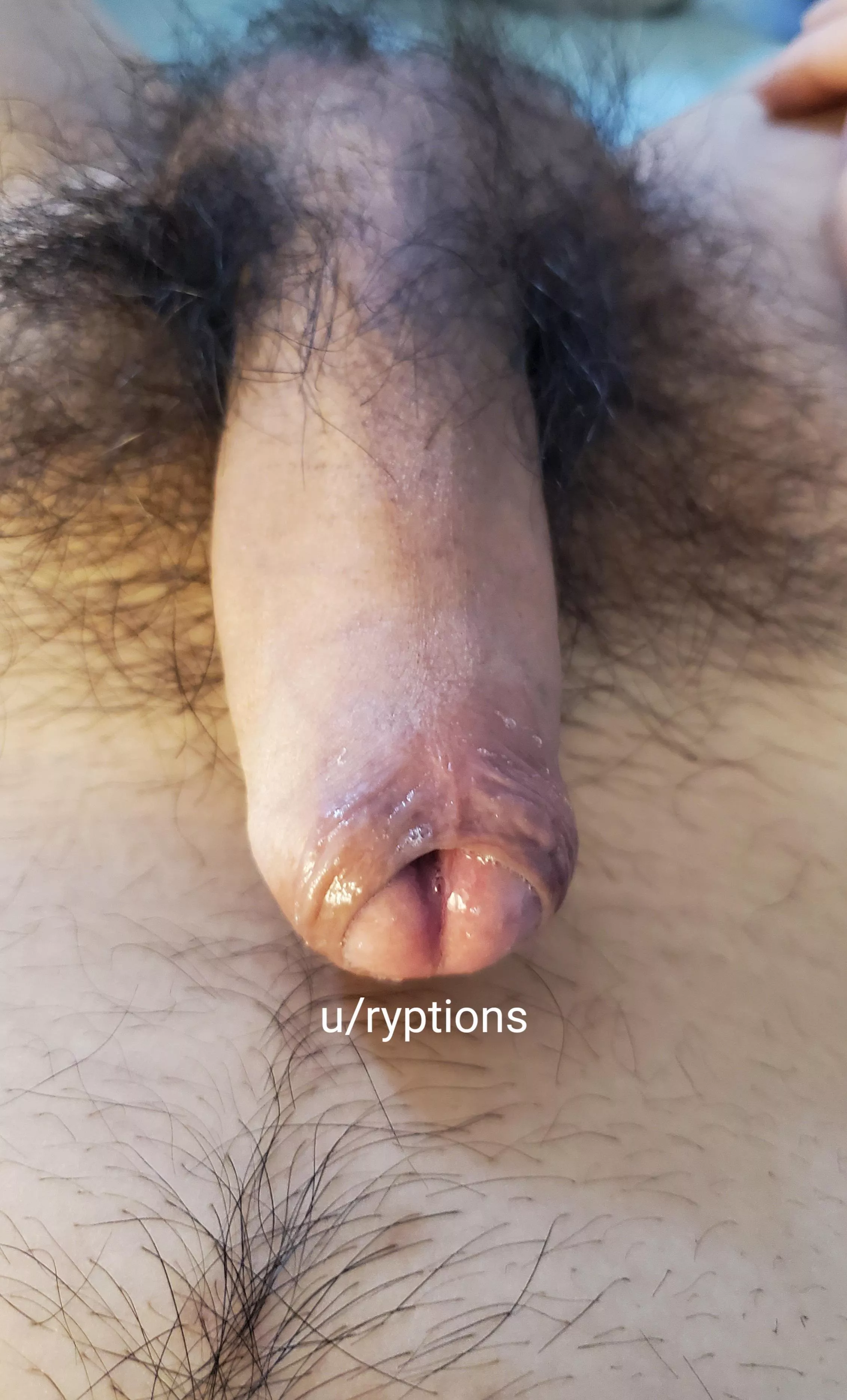 Starting to leak...💧