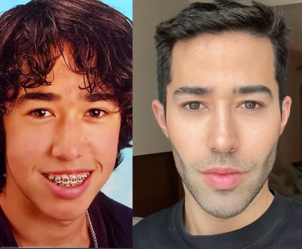 Teenage years were tough 😂