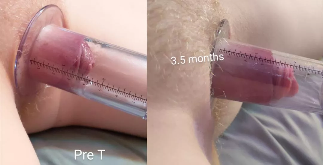 testosterone + pumping does wonders 🥰🥰