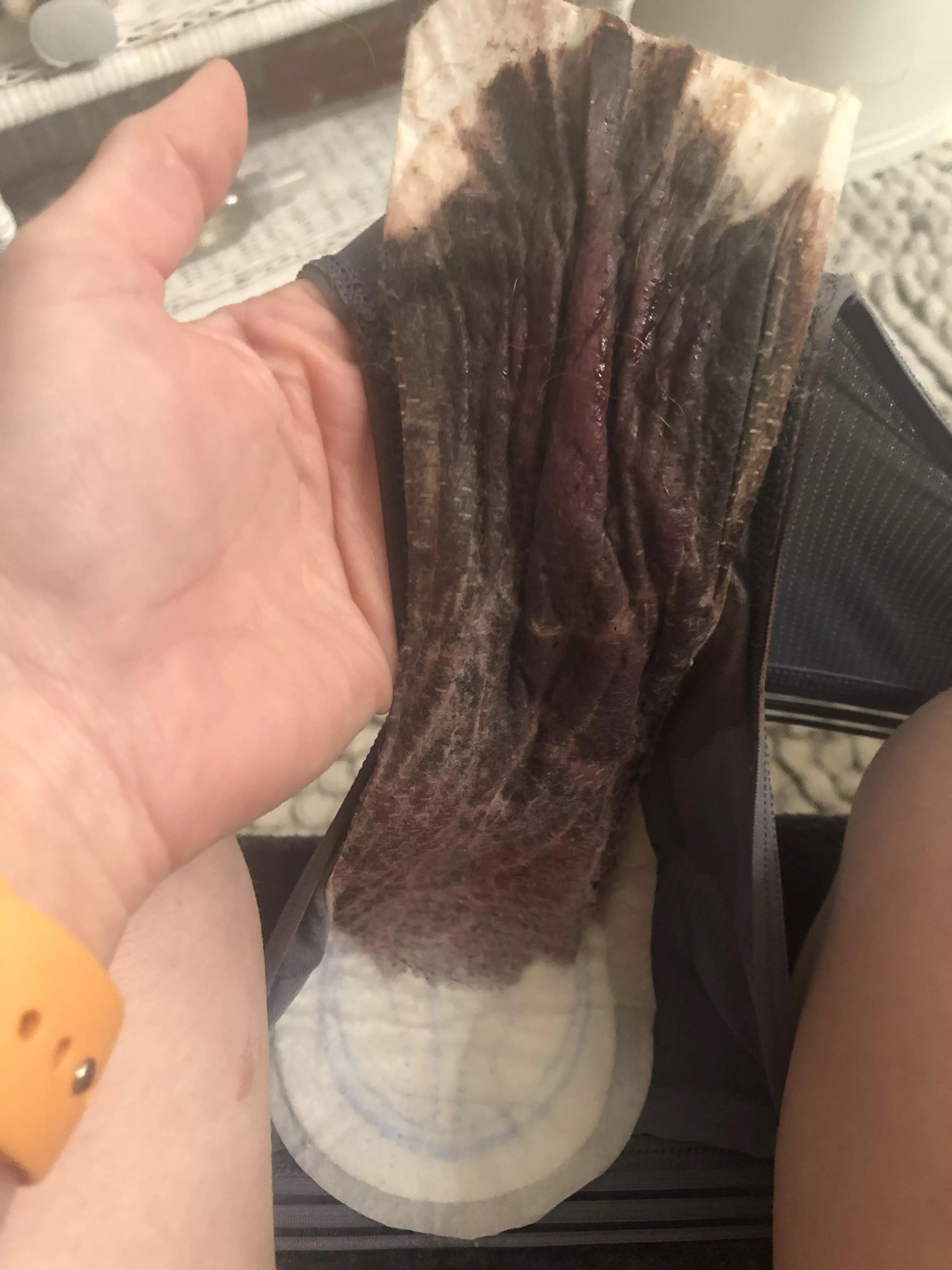 🩸What happens when I’m way too busy to change my pad all day 😝😝