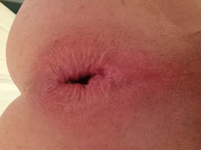 Wish you were here to eat this gaping hole of mine 💚