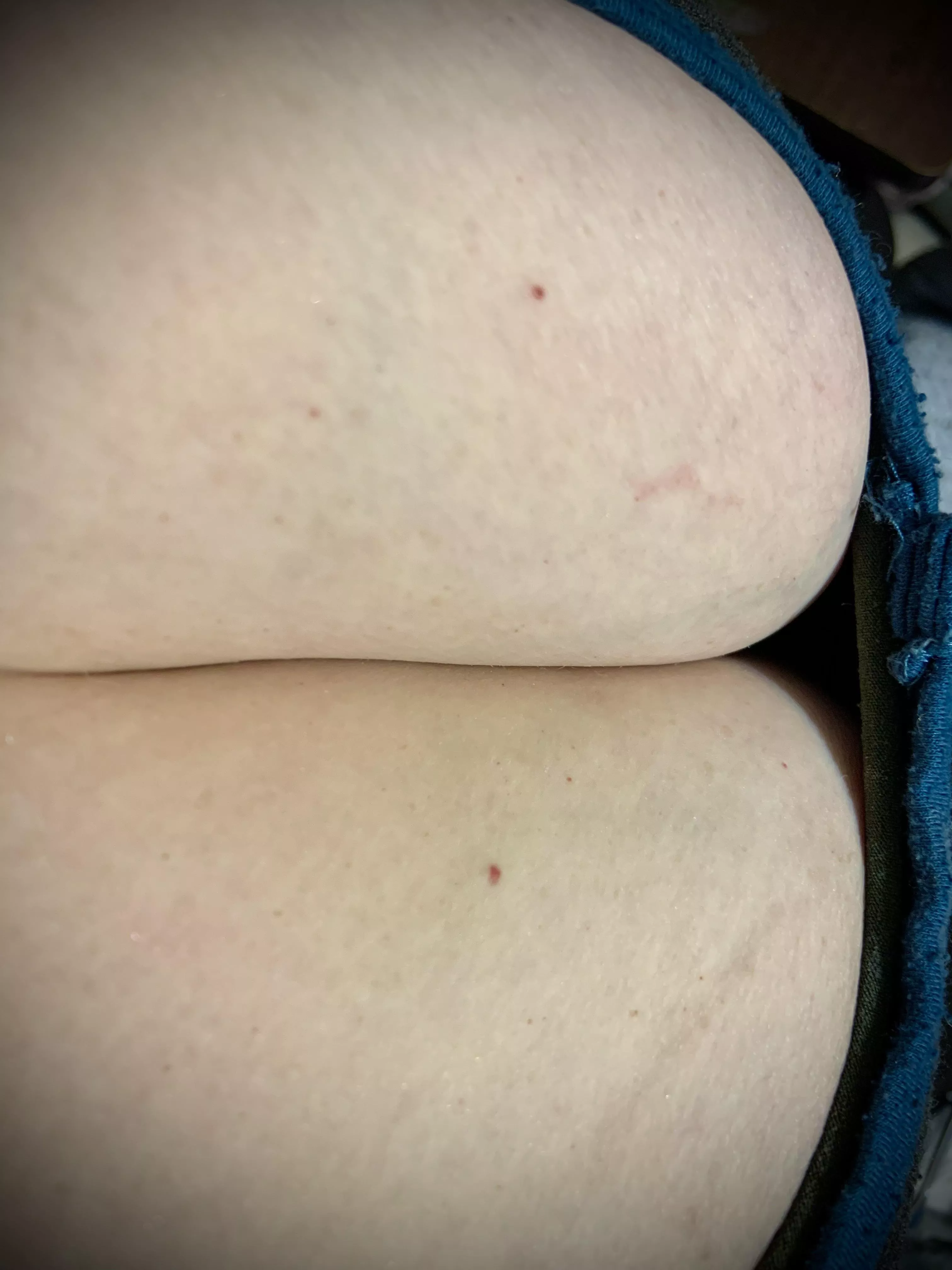 ⭐️Work Cleavage⭐️