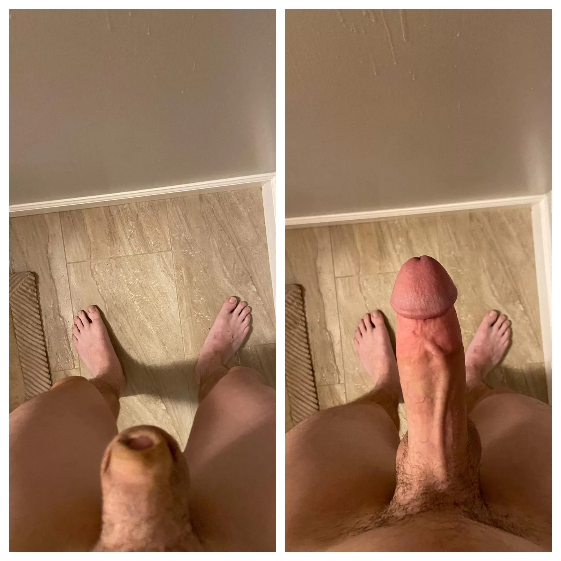 🙈