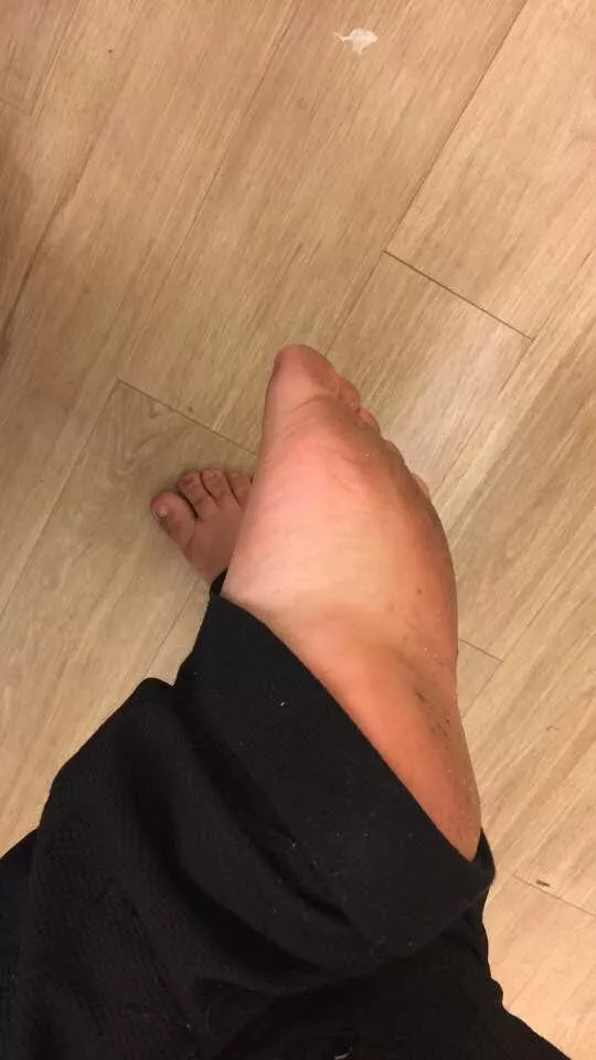 🦶🏻