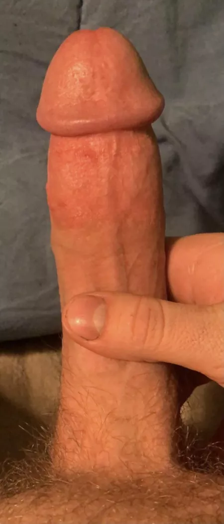 20y/o cock cut at birth