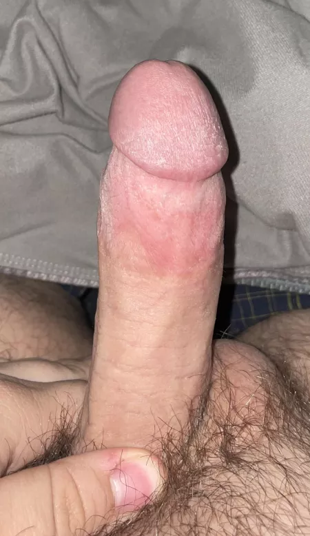 [22] Woke up like this, and I figured I’d give y’all a pic before I handled it.