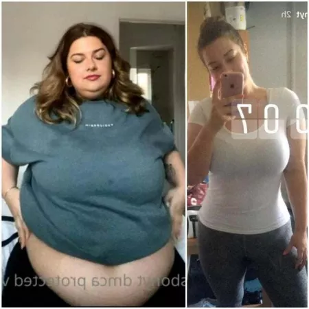 Aliss Bonython's weight gain before and after