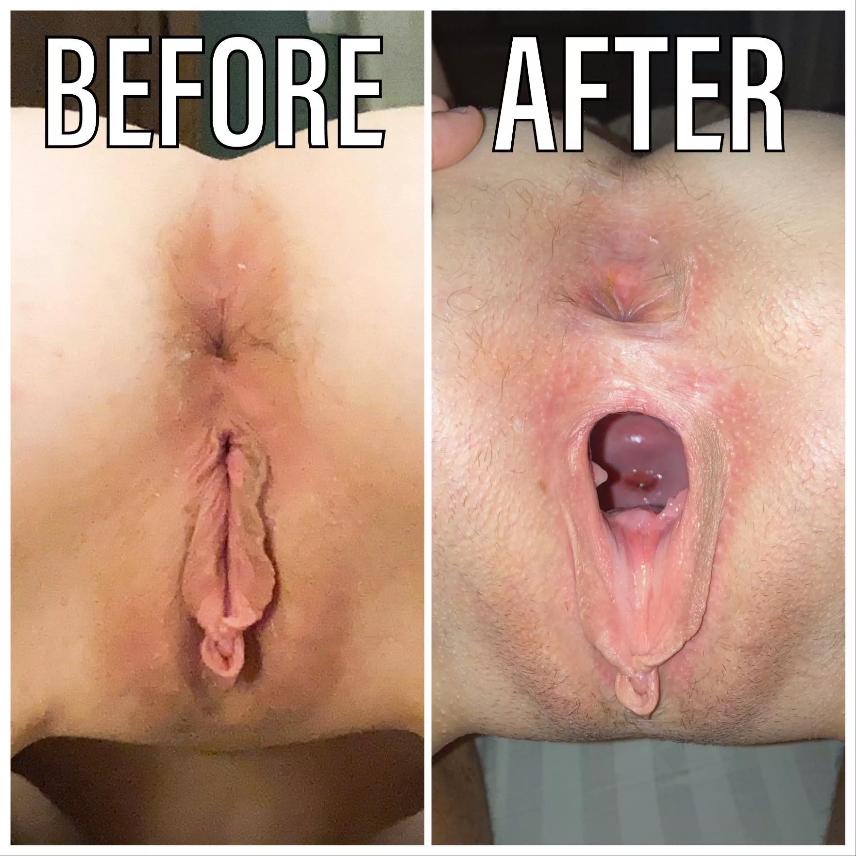 Beautiful before/after shot of one of my favorite sluts after my big thick cock put some seriously mileage on her hole. Check out that cervix shot. Show her ruined pussy some upvote/comment love. Beautiful before/after shot of one of my favorite sluts after my big thick cock put some seriously mileage on her hole. Check out that cervix shot. Show her ruined pussy some upvote/comment love.