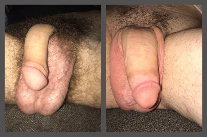 bestfriend (left) and I (right) wanted to soft compare, which do you prefer?