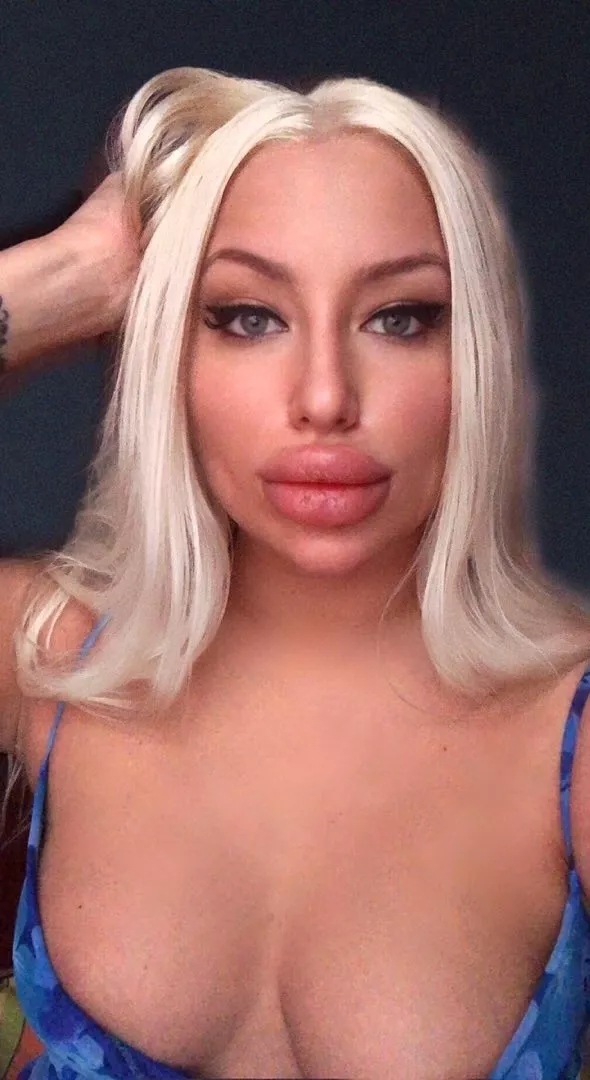 Big Fake Lips