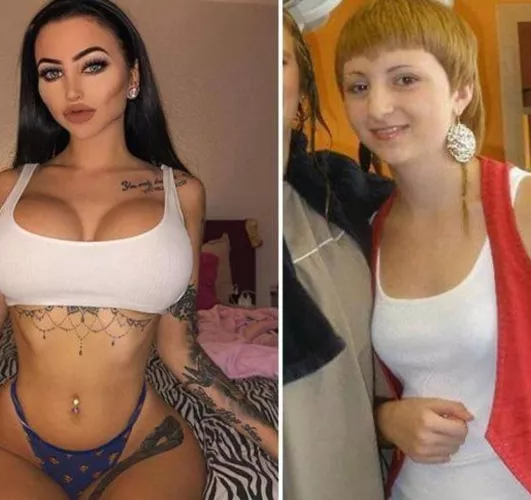 @Ccentino Celine Centino before & after %¯ perfec.t Insta: @GodTierPlastic