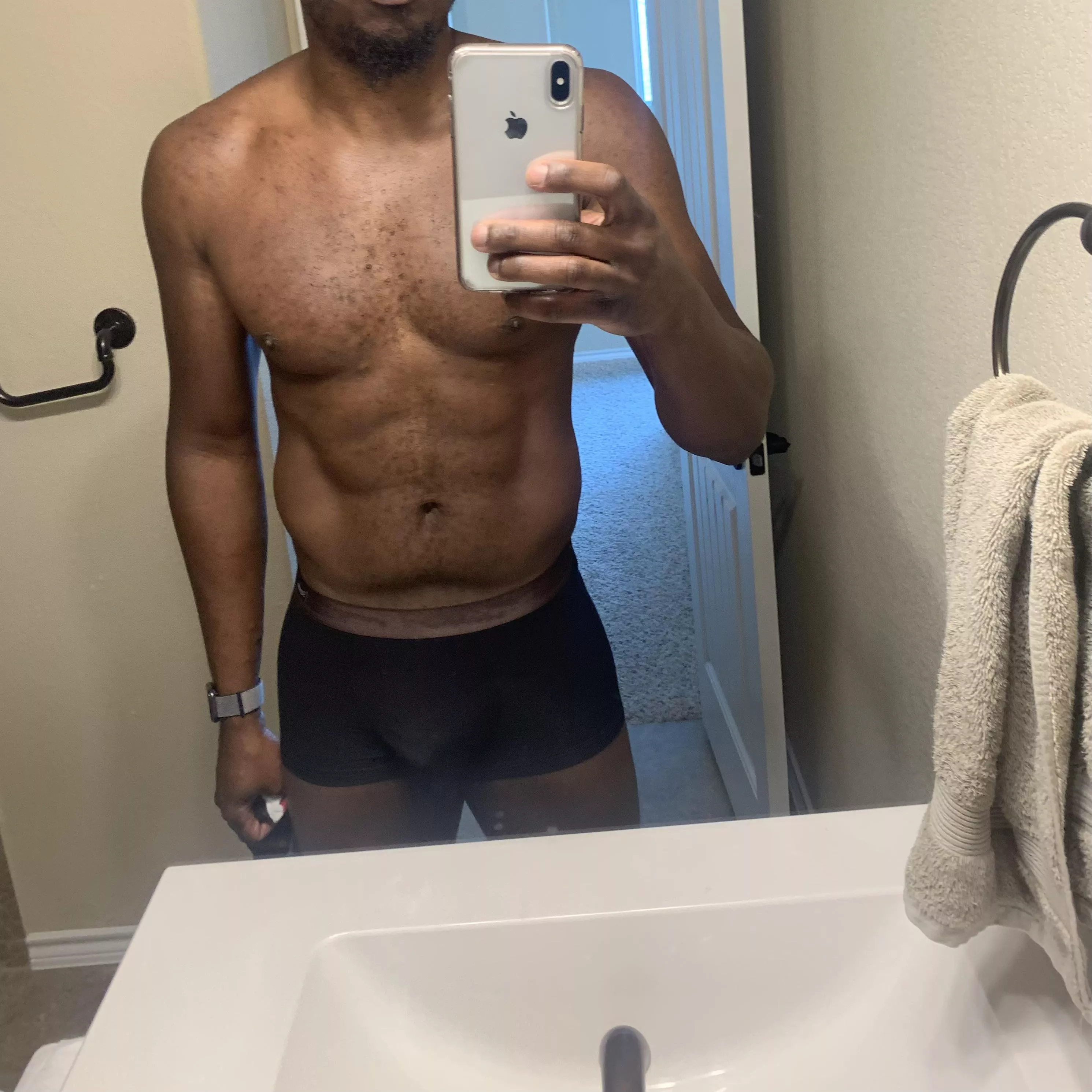 Do I qualify?