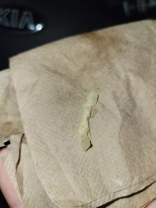 For the last while I've had a reoccurring blocked tear duct and pain. Well I just blew this out and had instant relief