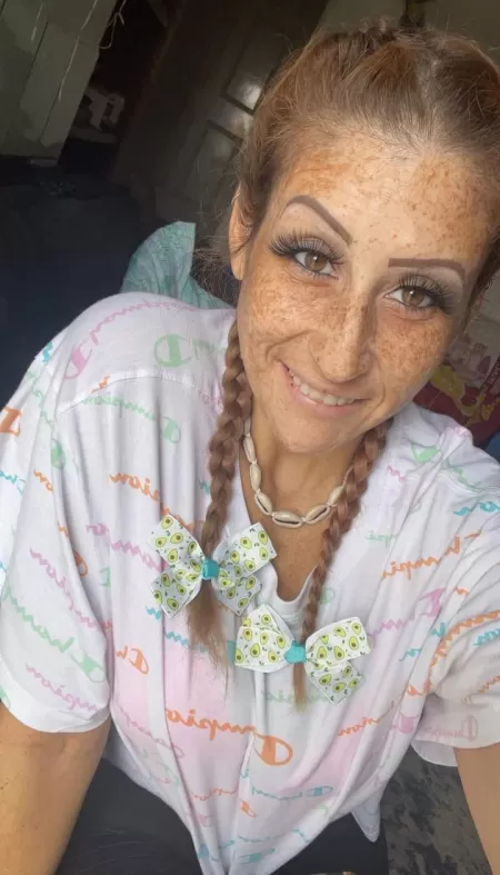 Freckles and pigtails ๐ฅ๐ฅ Freckles and pigtails ๐ฅ๐ฅ