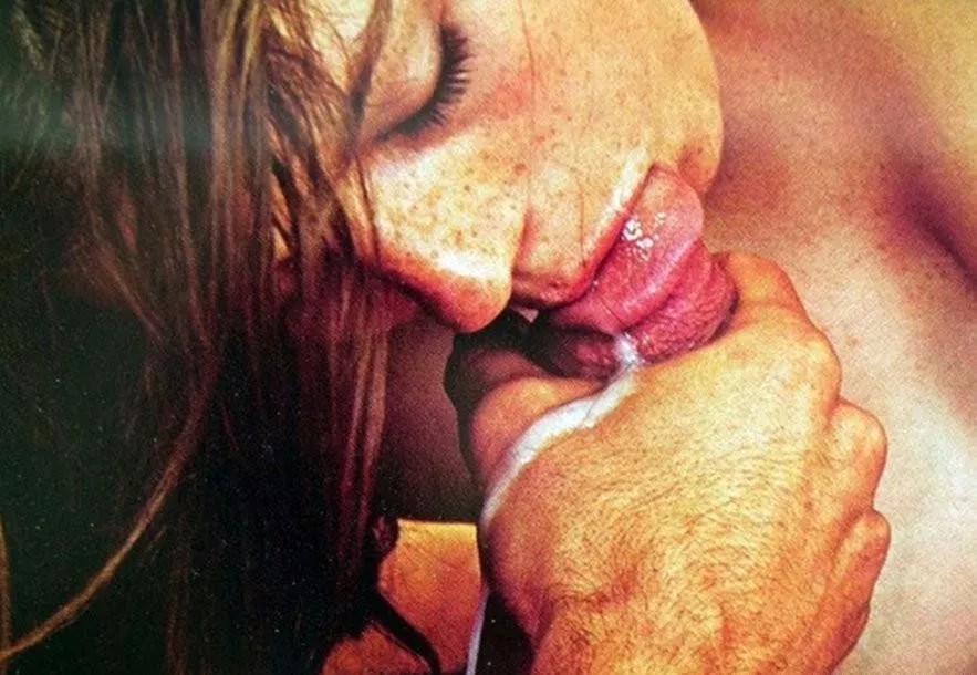 Freckles