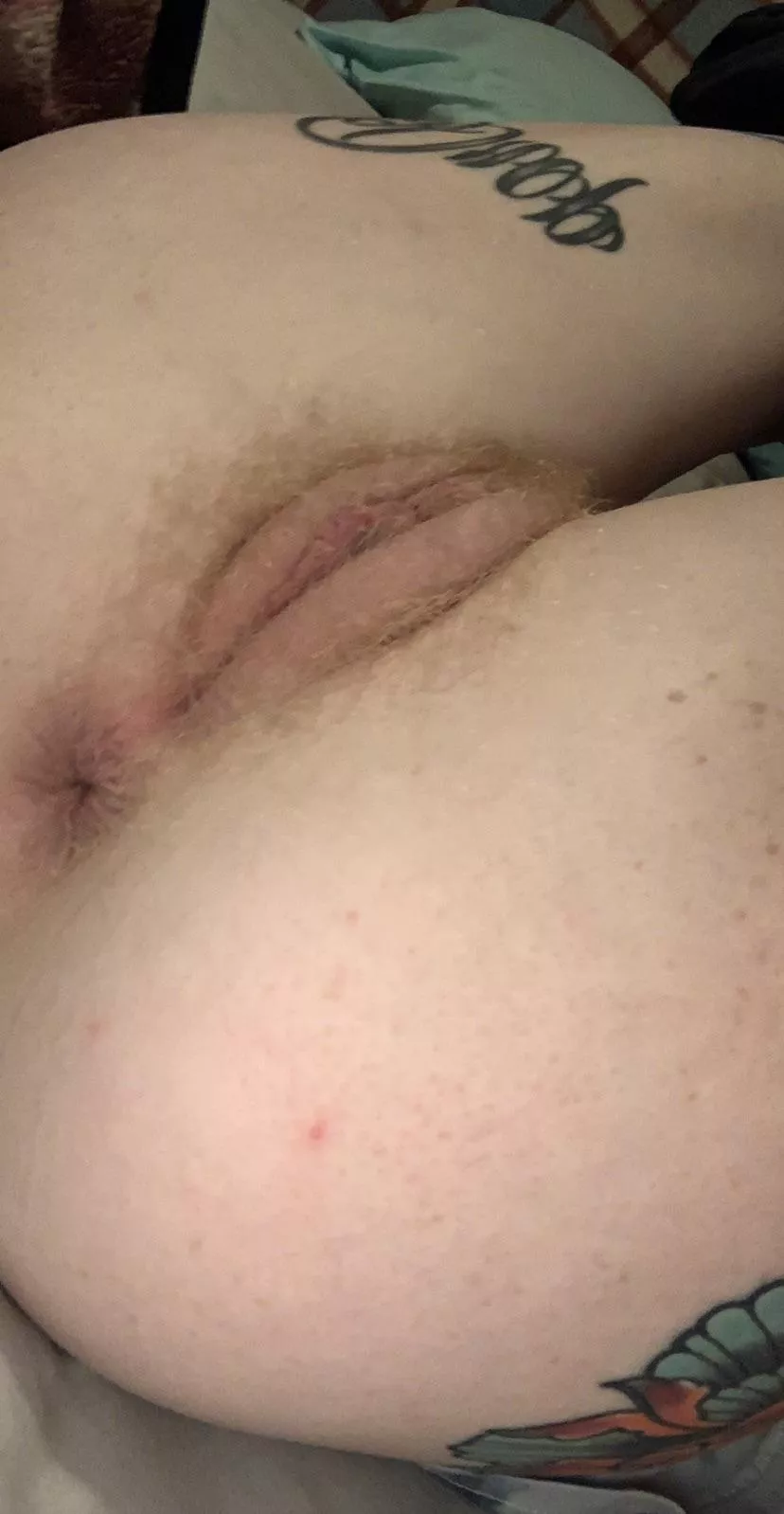 Ginger hairs