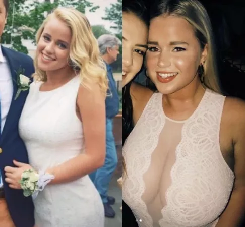 Girl went from small to gigantic