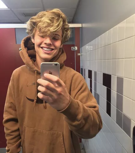 Hi! How you find my new braces? I think they don’t look good 😰😔