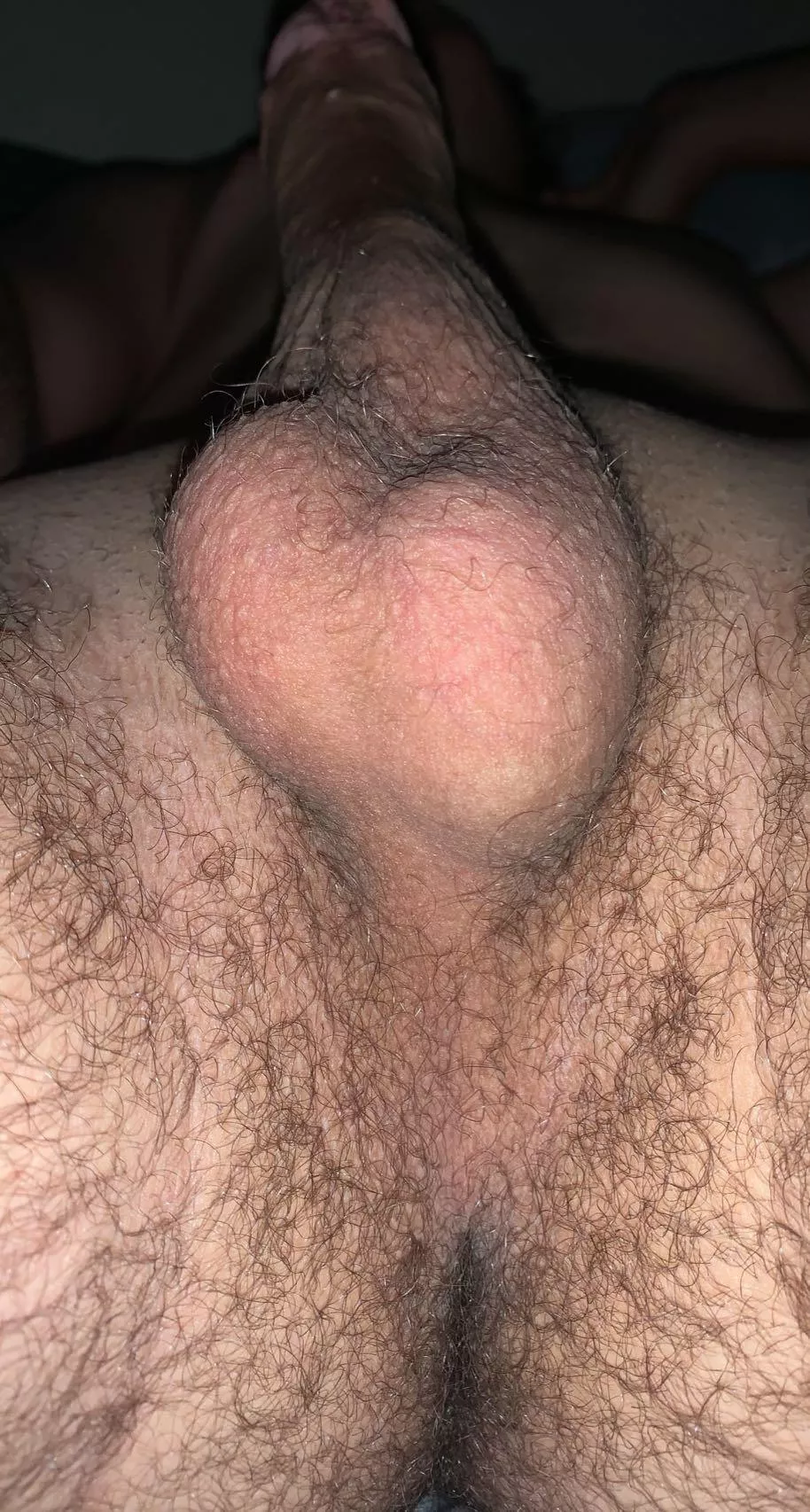 How are my balls and taint looking?