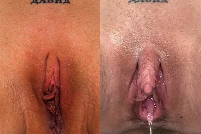 I always love sharing before & after pics of my big clit enlargement. Look how far I’ve cum! 🤤😈