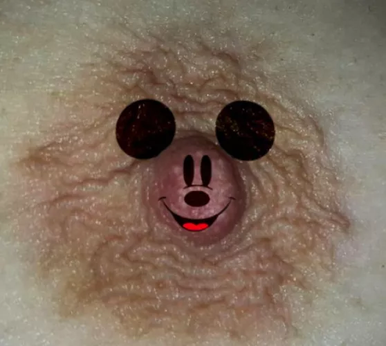 Mickey nips....