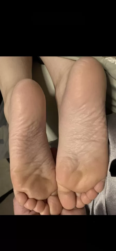 My wife’s wrinkly soles