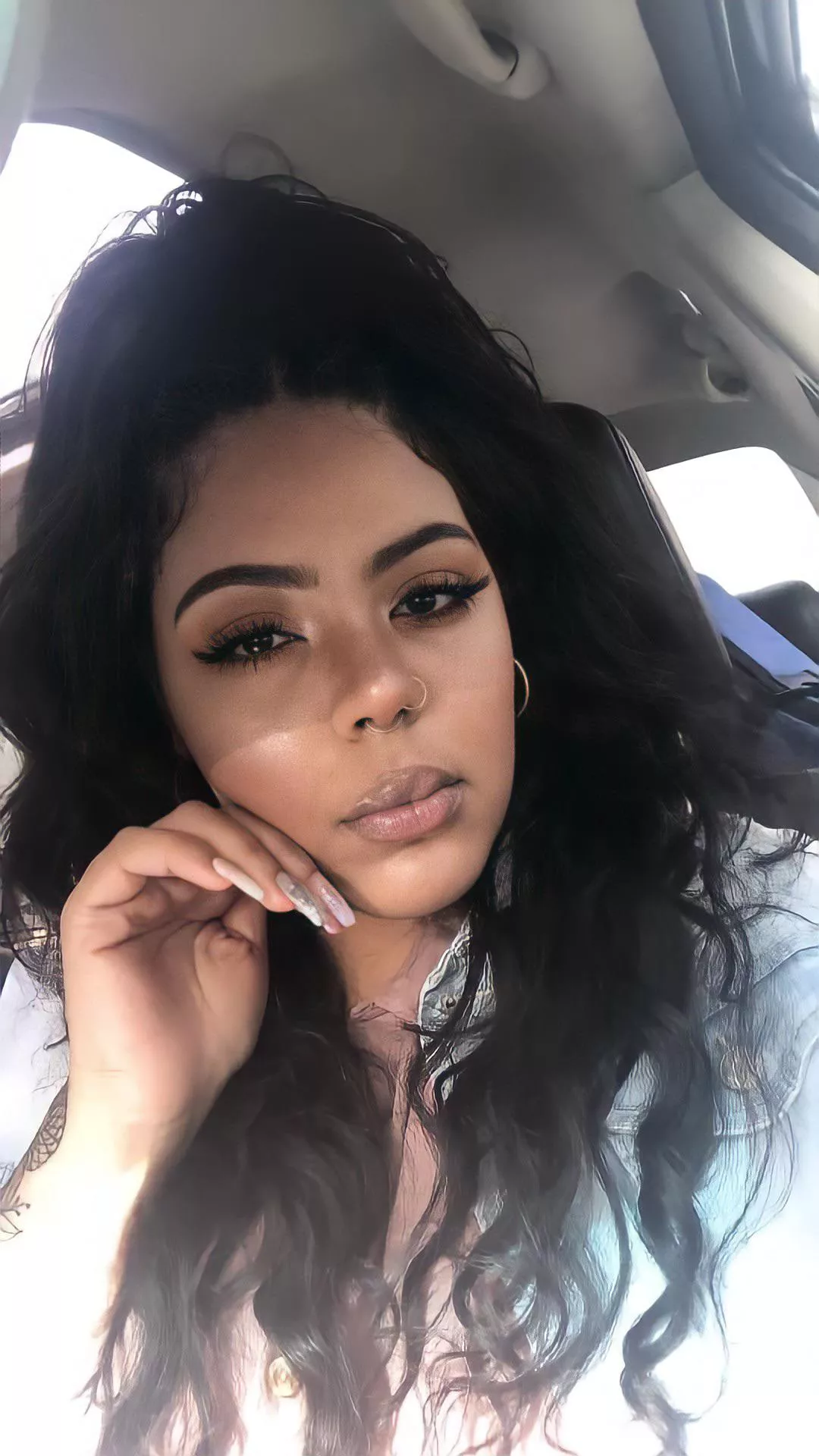 Puffy top lip