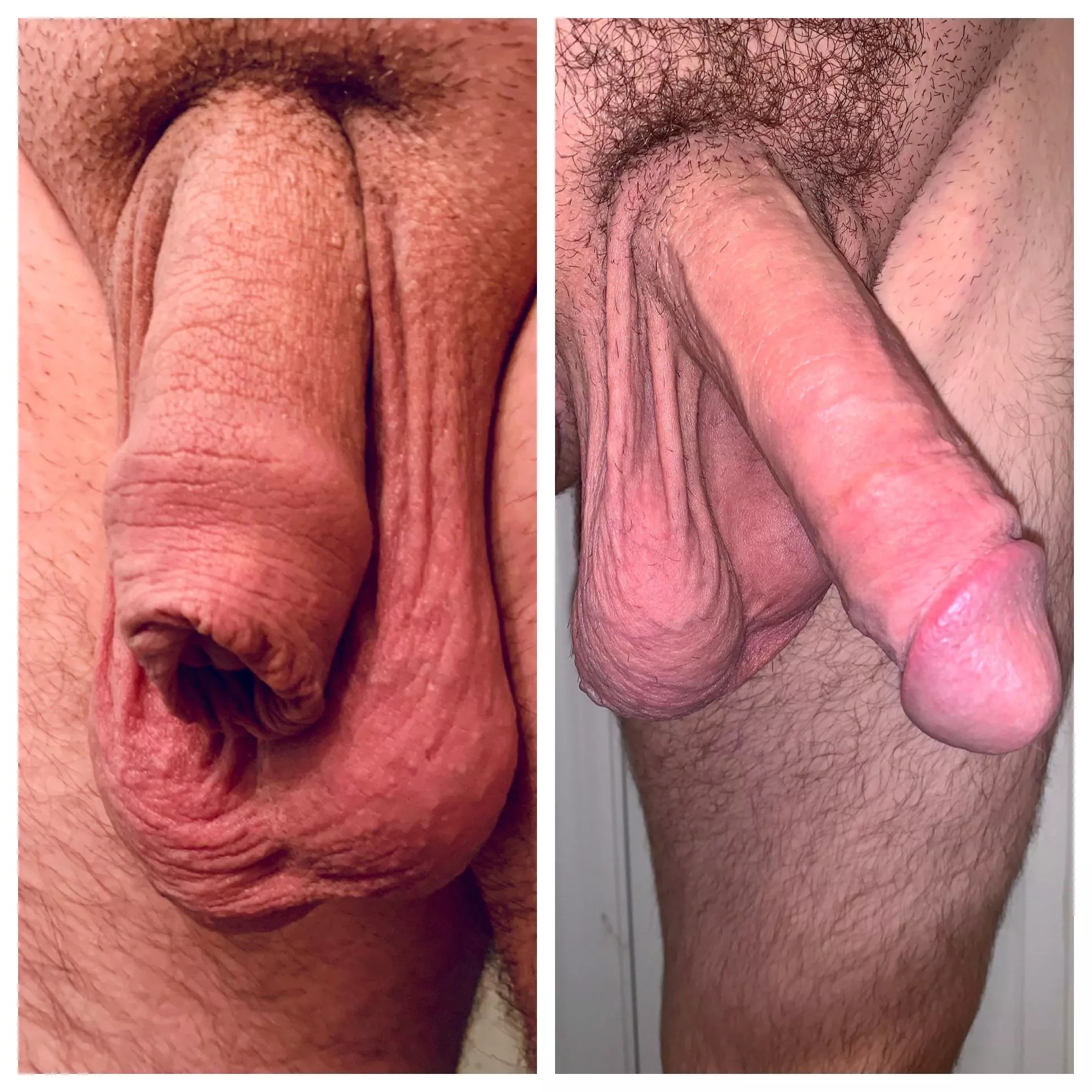 Restored Foreskin here 👋🏻 long ways to go still!