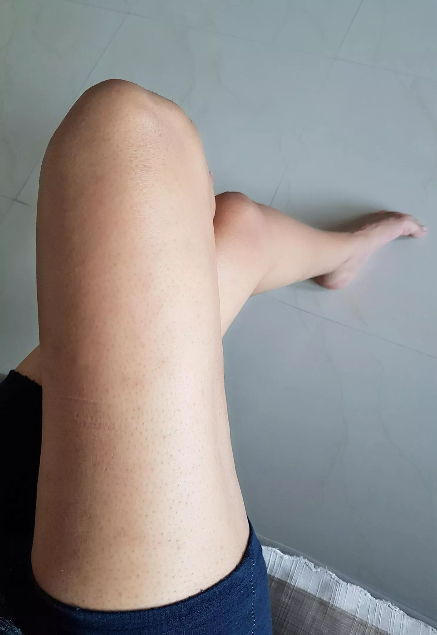 Runner's feet