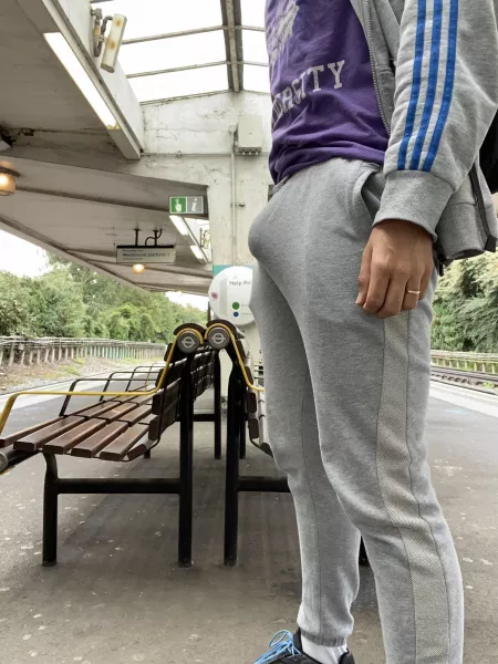 “Scally bulge” …