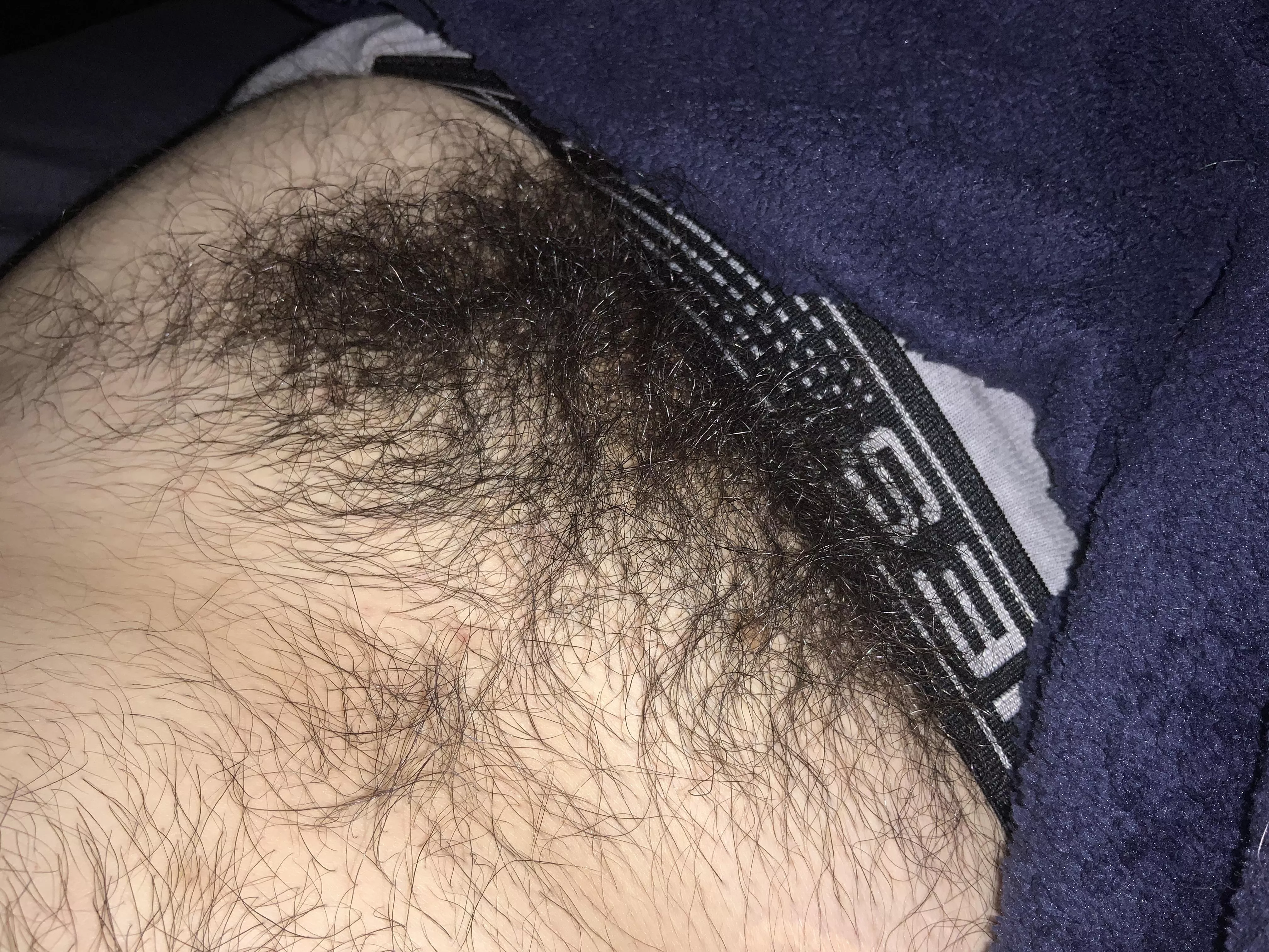 should i trim?