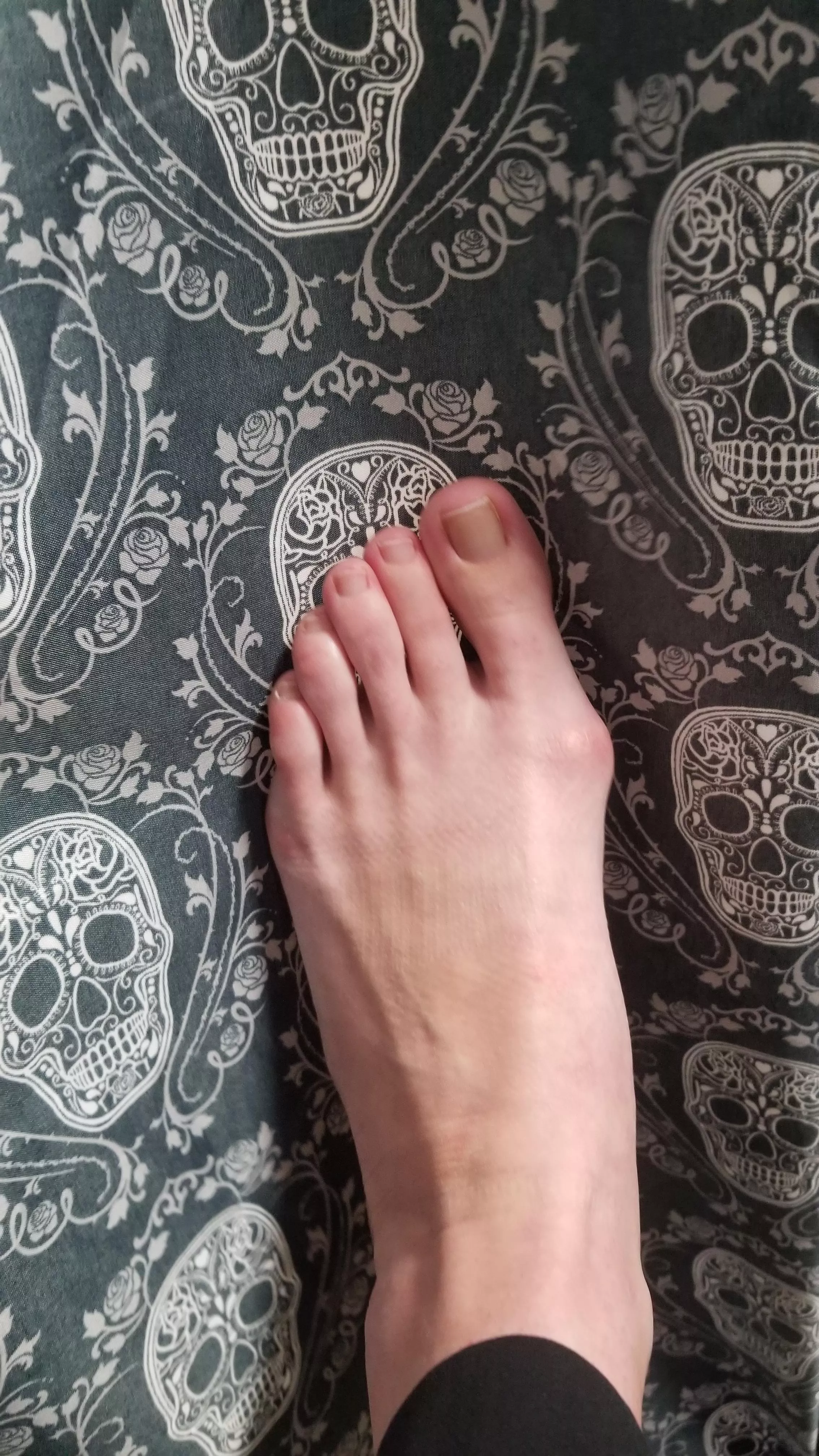 Size 11 female feet w/ bunions. DM for more 💌