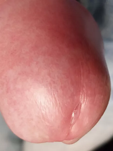 Too close? Too close?