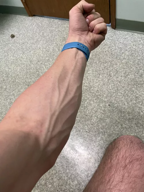 Veins for days…