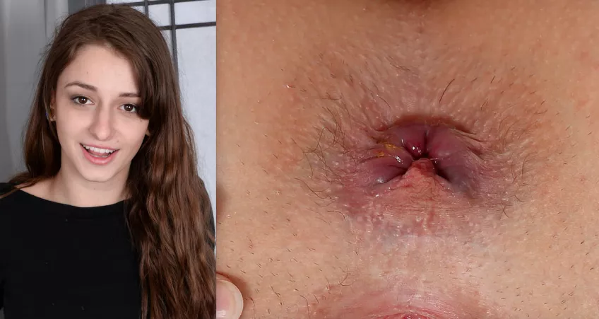 Willow Hayes' Asshole