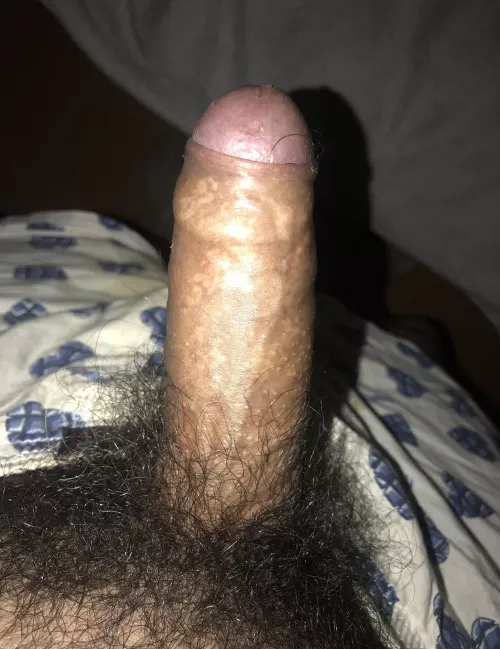 Yeah, it’s hairy…